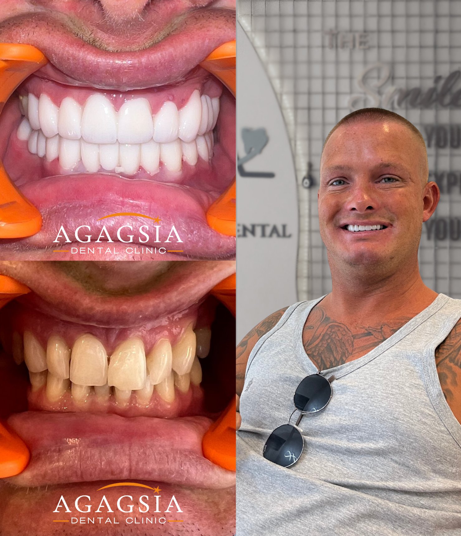 Hollywood Smile vakası