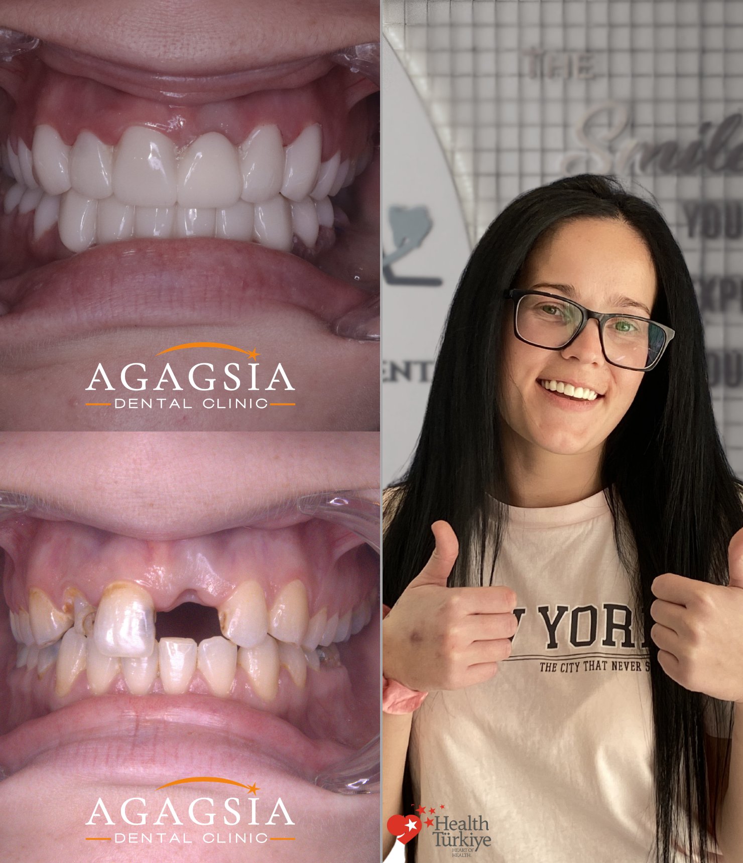 Anda — Hollywood Smile vakası