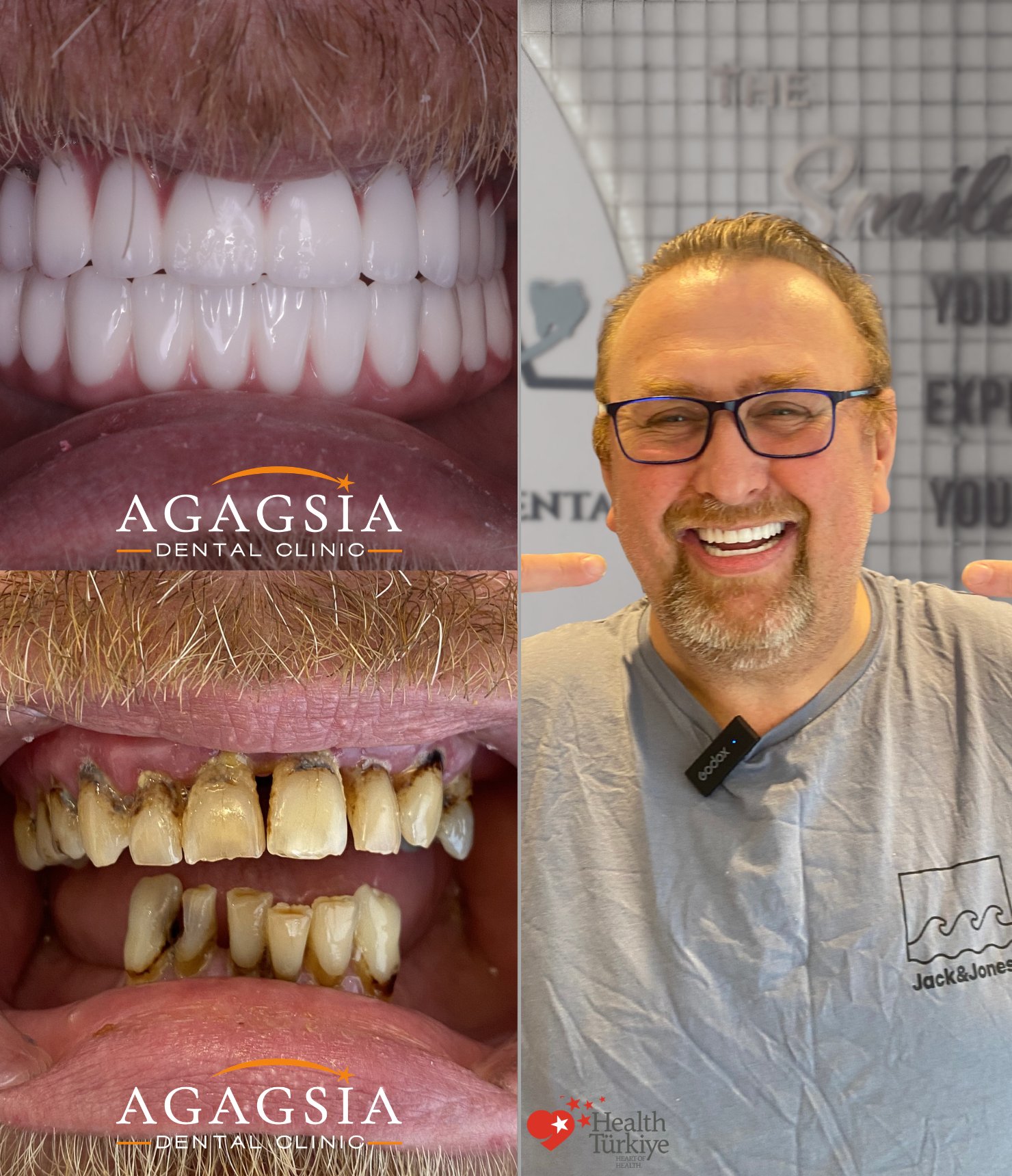 Andrew — Hollywood Smile vakası
