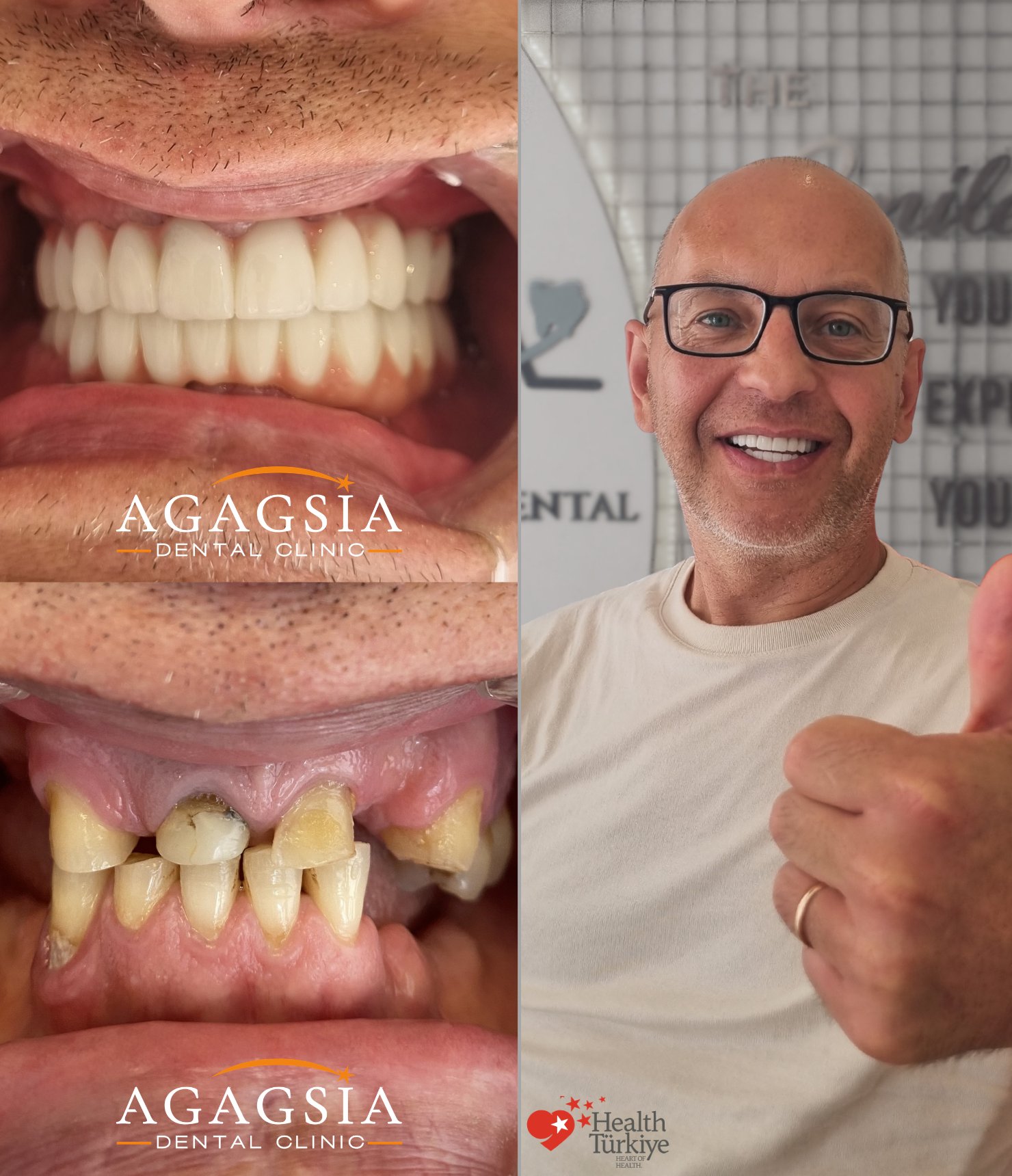 Armands — Hollywood Smile vakası