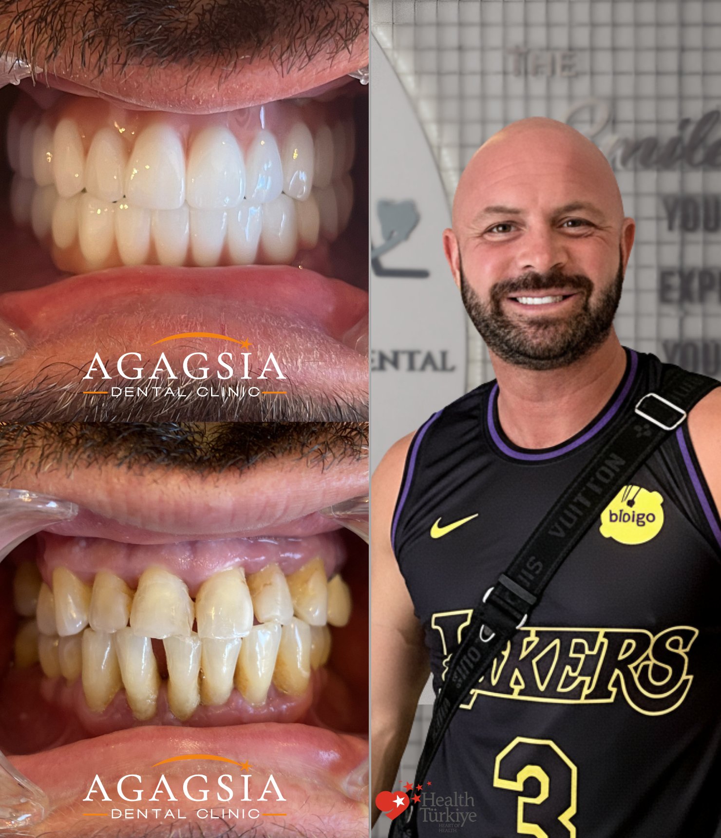 Barry — Hollywood Smile vakası
