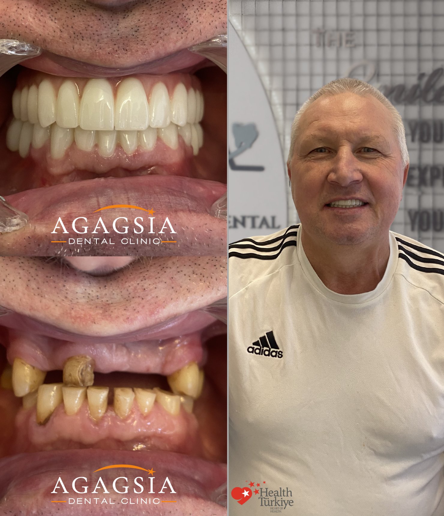 Hollywood Smile vakası