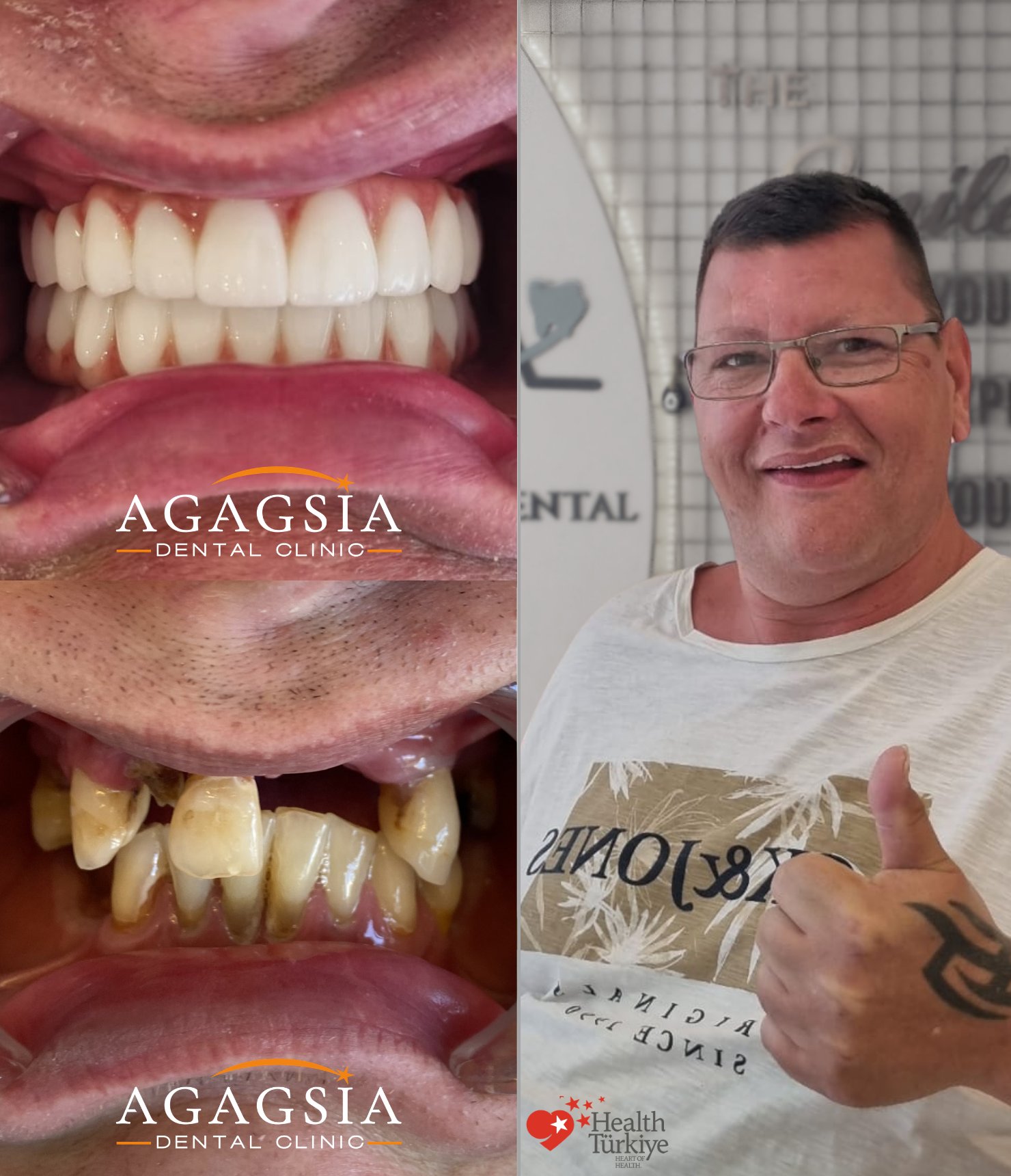 Corbett — Hollywood Smile vakası