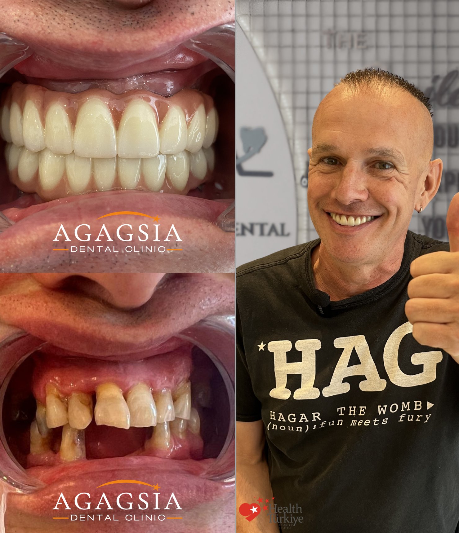 Craig — Hollywood Smile vakası
