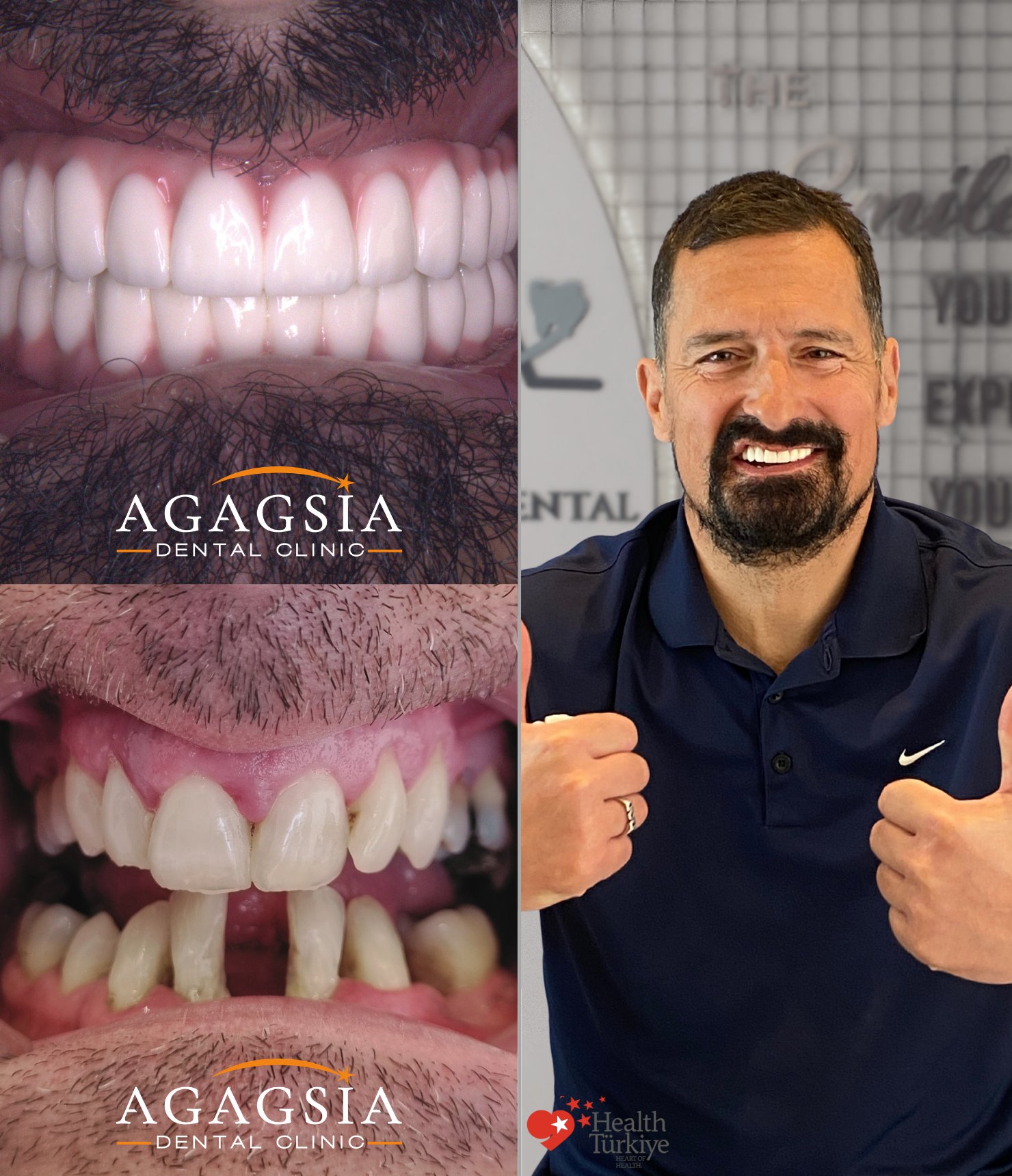 Paul — Hollywood Smile vakası