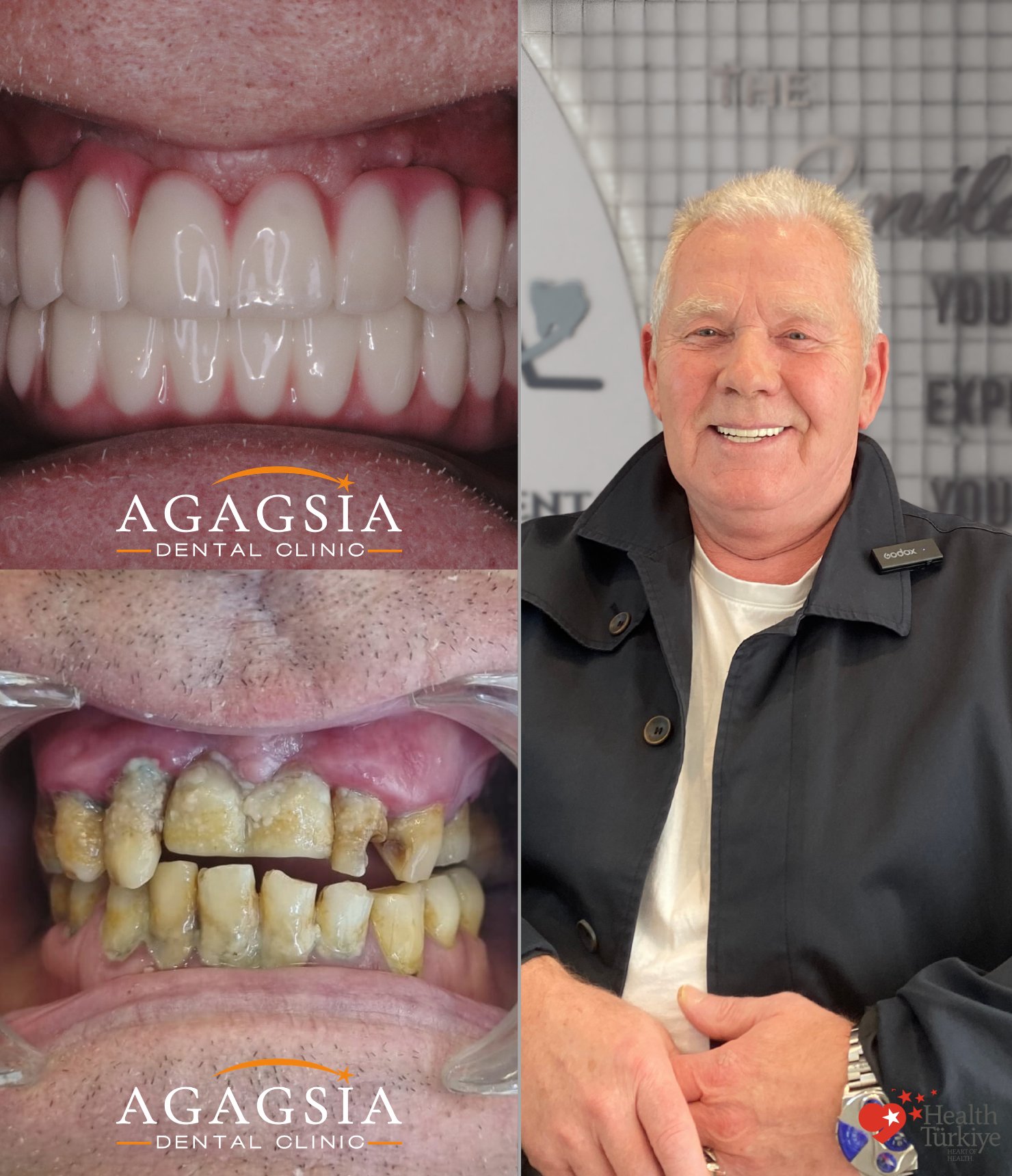 Hollywood Smile vakası
