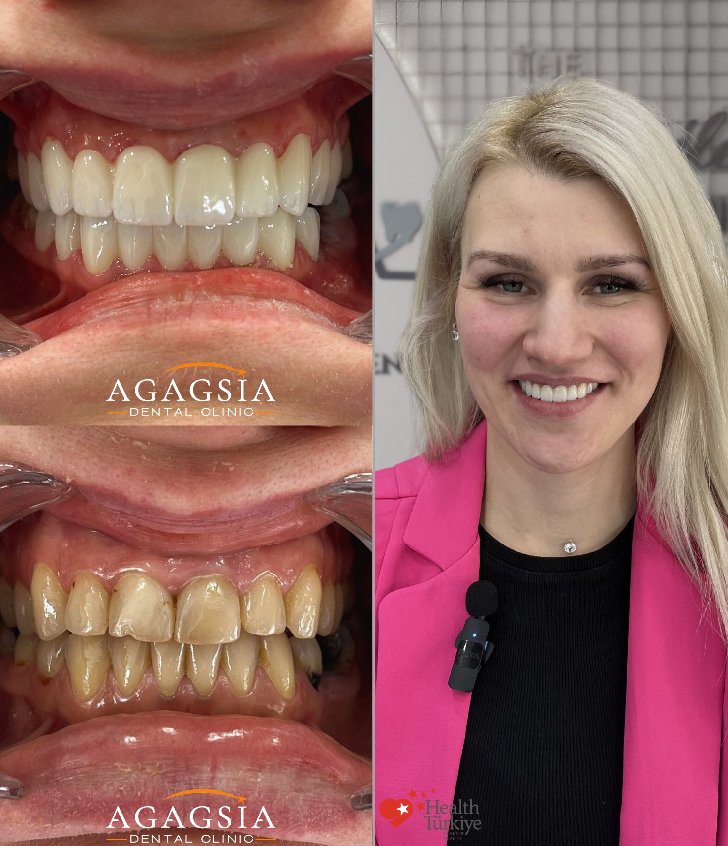 Sintija — Hollywood Smile vakası