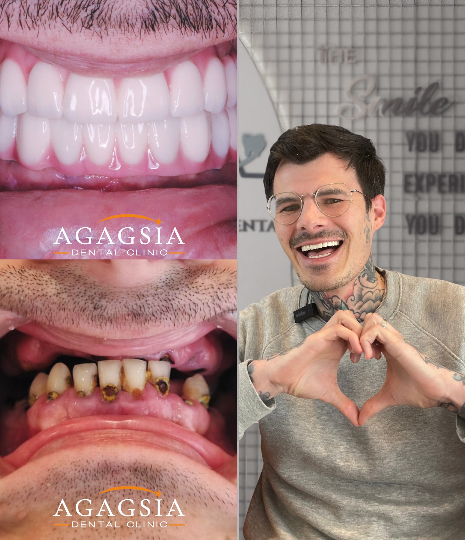Hollywood Smile vakası