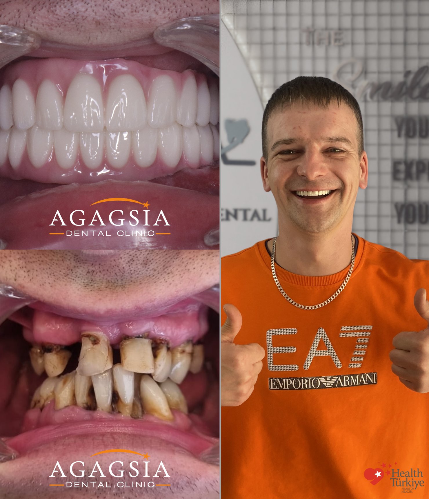 Hollywood Smile vakası