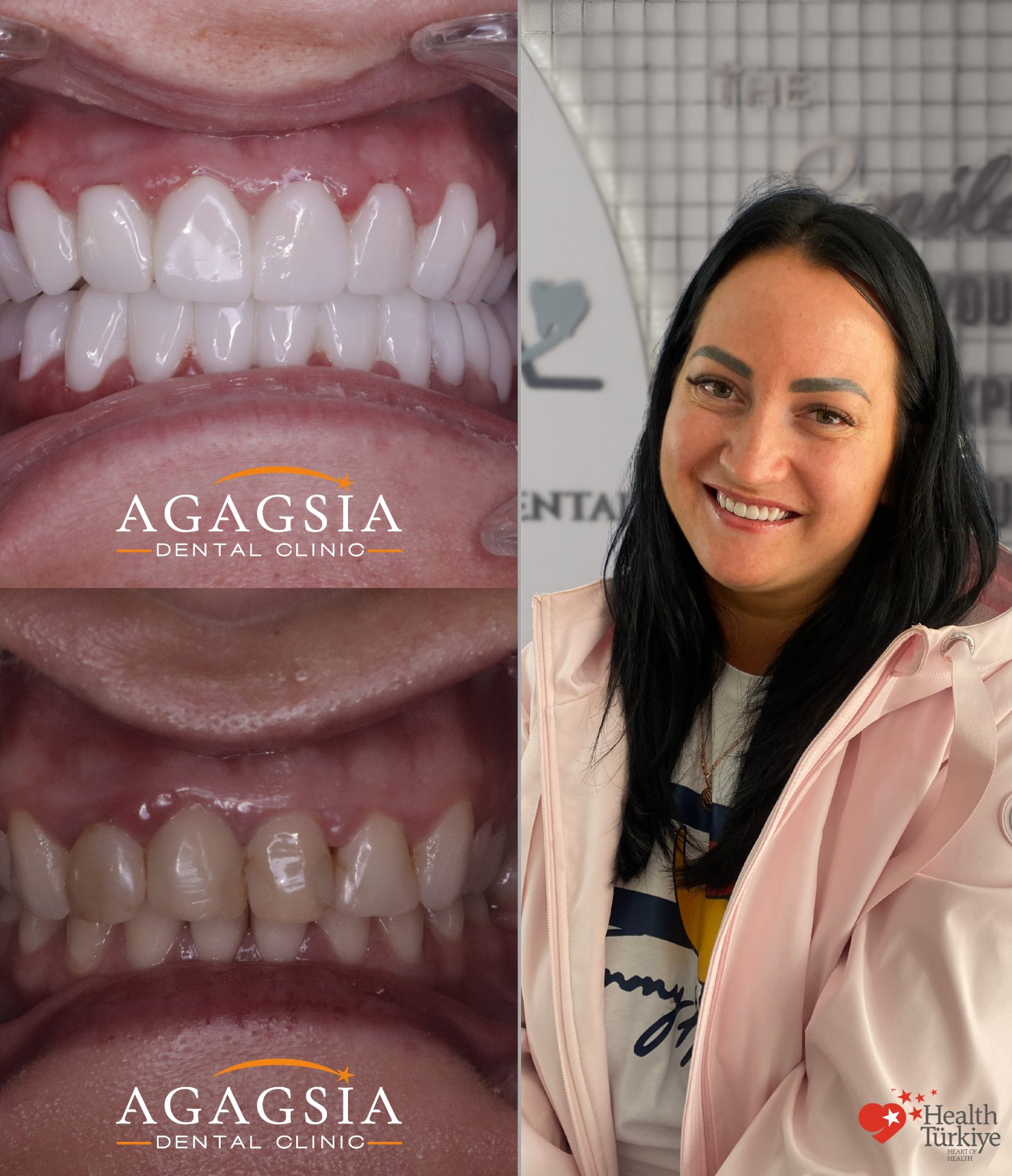 Hollywood Smile vakası