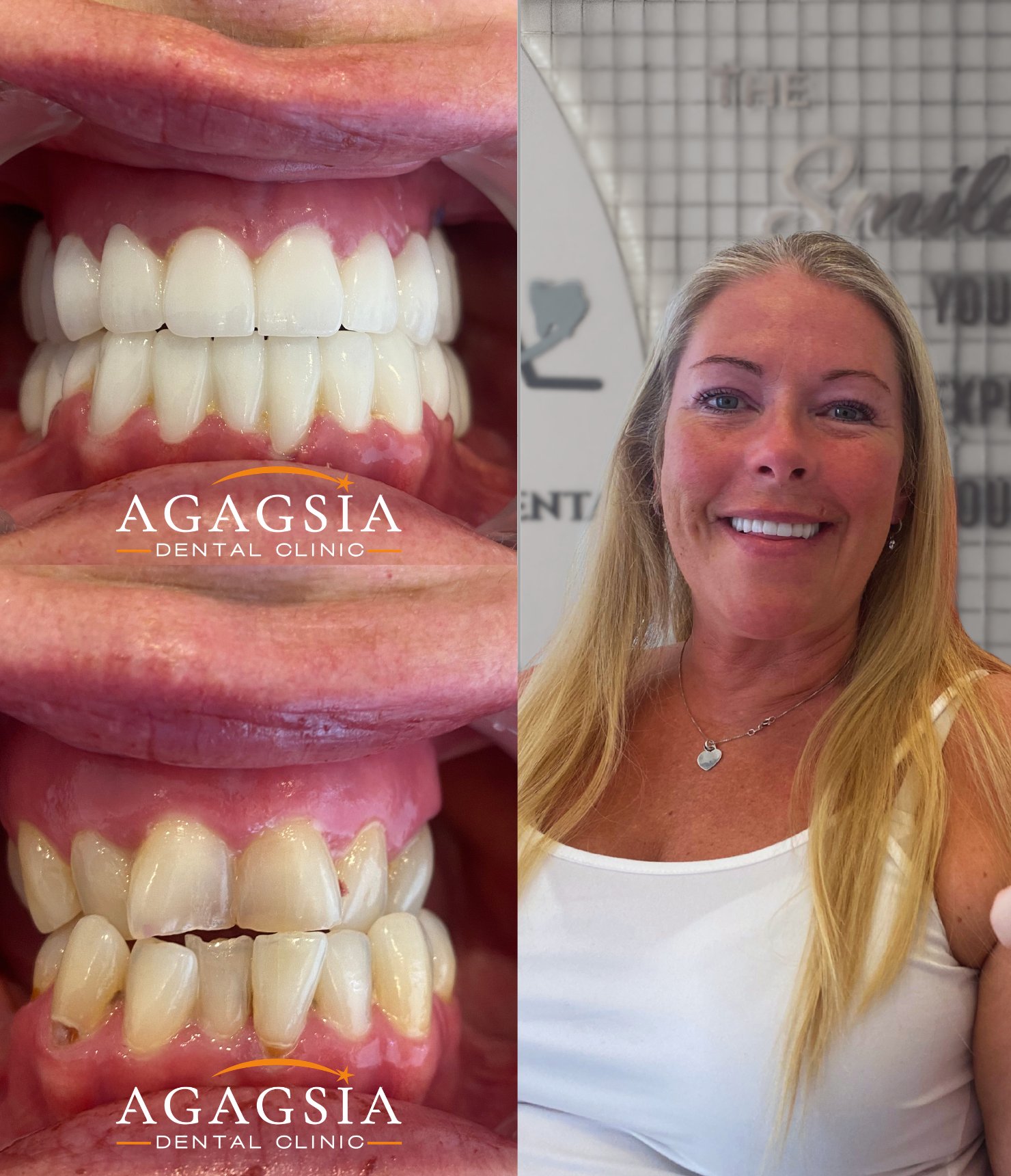 Hollywood Smile vakası