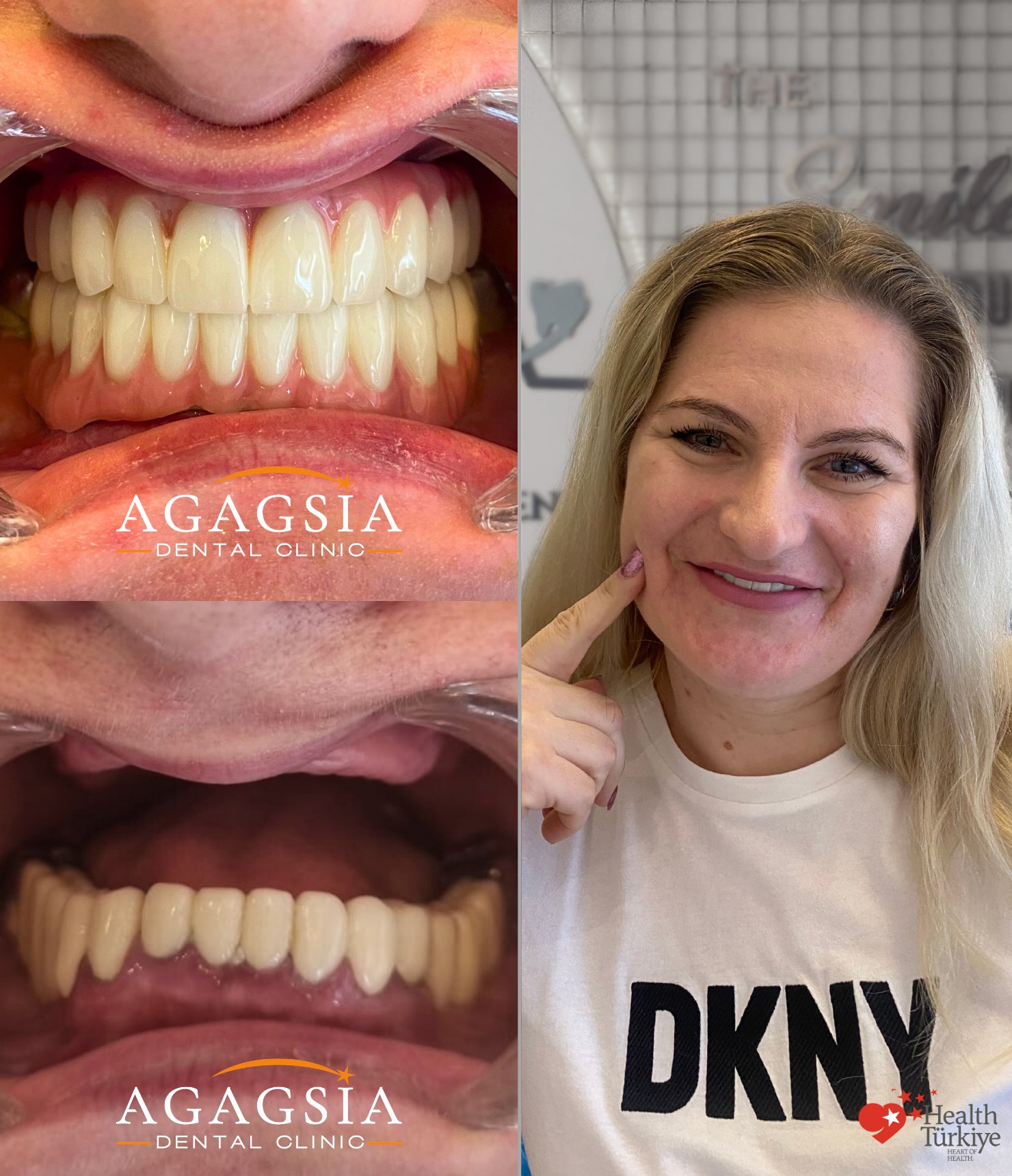 Georgiana — Hollywood Smile vakası