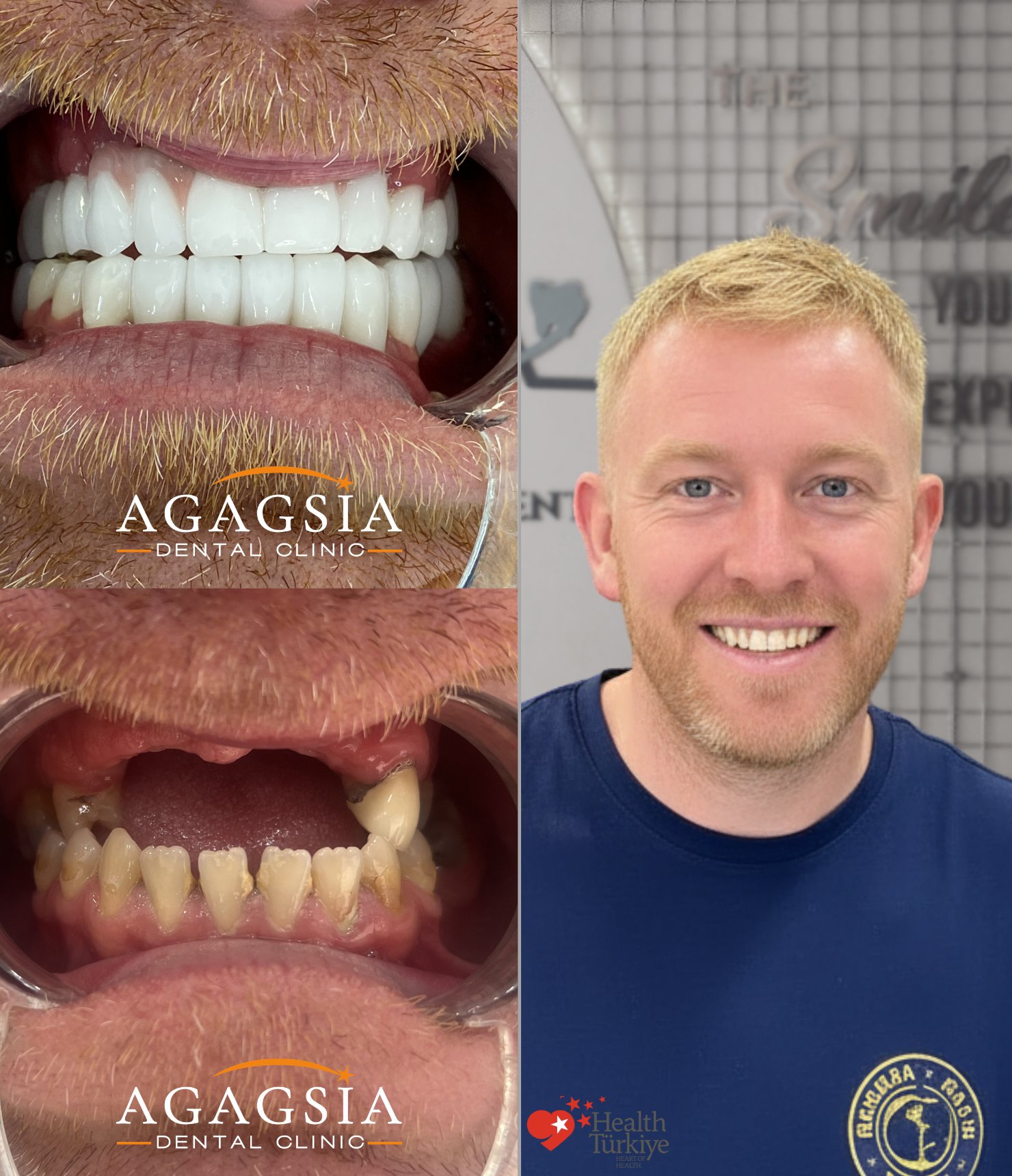 Robert — Hollywood Smile vakası