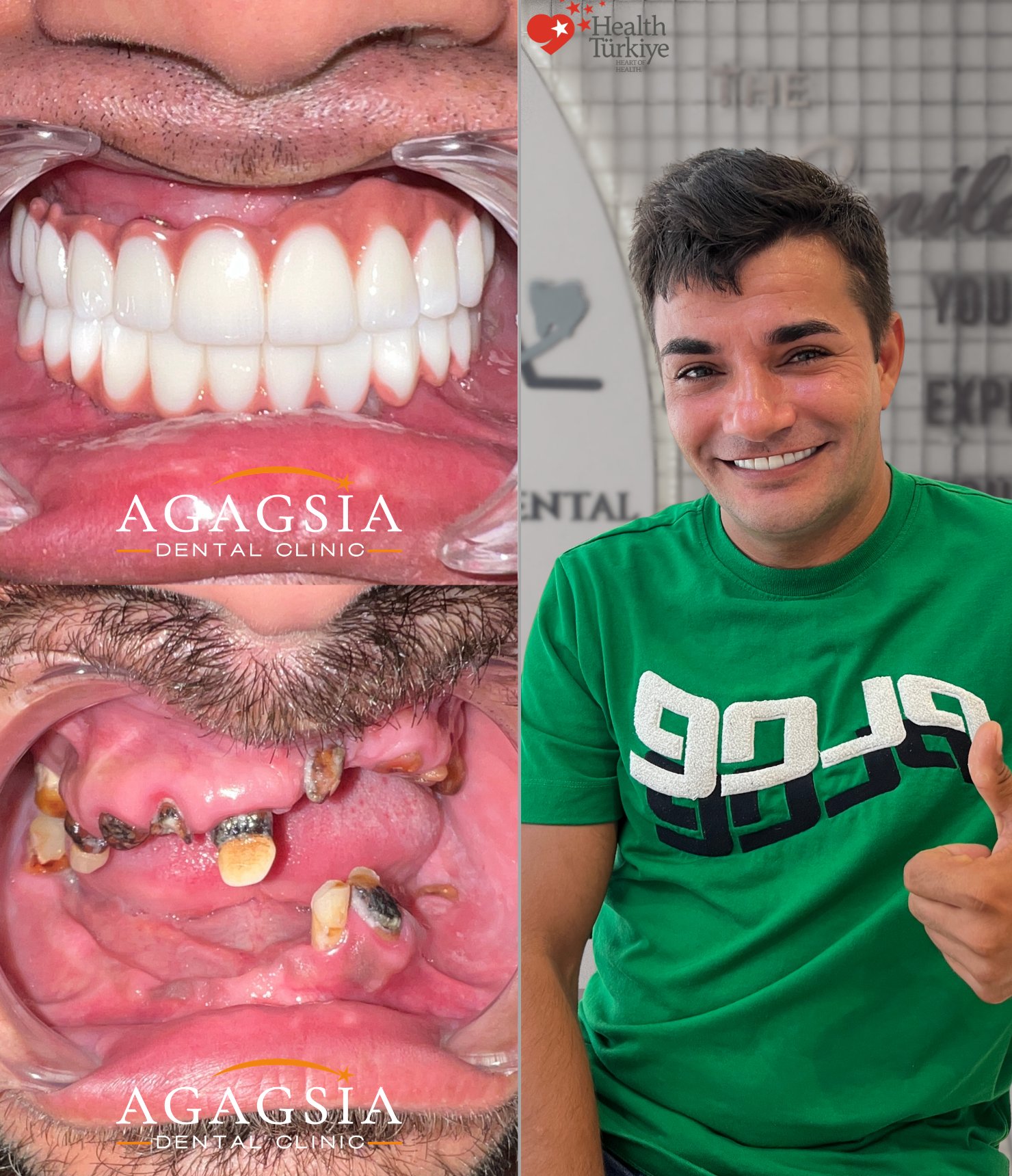 Hollywood Smile vakası